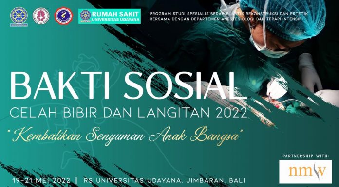 Kembalikan Senyuman Anak Bangsa, NMW Group Denpasar Dukung Bakti Sosial Bibir Sumbing